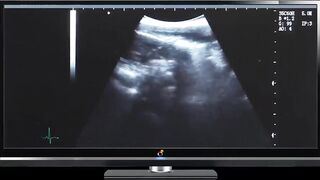 Ultrasound Preggo Slut Choked Gushed Cum Flooded Womb Destroyed