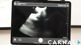 Doctor Legrand destroys Grant’s tight ass with his massive cock bareback