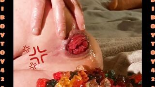Gay Gummy Bear Anal Stuffing Prolapse Deep Gape